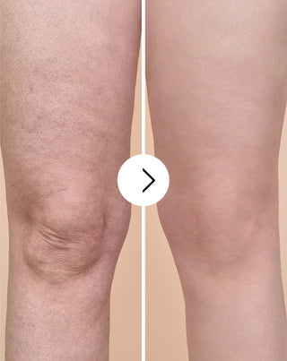 Cellinea tabletten tegen cellulitis en verbetering van de huidconditie met natuurlijke extracten 60 capsules_4 - 4