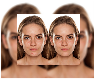 Comprimés Derminax avec zinc et vitamines C, E et B2 pour l'acné, les boutons et les imperfections - 6