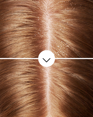 Shampooing antipelliculaire Nutridome à la piroctone olamine à effet hydratant - 5