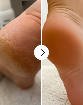 Verzachtende voetcrème met ureum en sheaboter Nutridome - 4