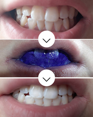 Sérum correcteur de couleur de dents White Bite Smilebite 30 ml - 3