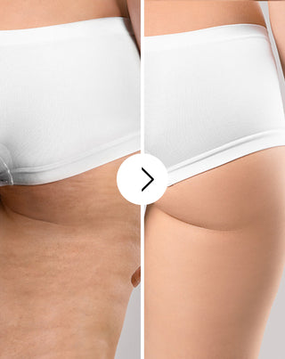 Comprimés Cellinea contre la cellulite et l'amélioration de l'état de la peau aux extraits naturels 60 capsules - 4