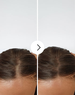 Follixin capsules tegen haaruitval met een verdikkende en versterkende werking 60 capsules