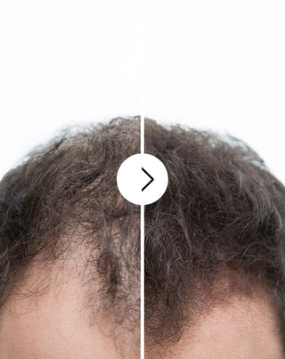 Capsules Follixin contre la chute des cheveux avec un effet épaississant et fortifiant 60 capsules - 6