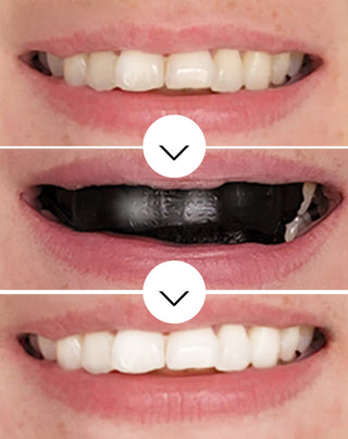 Ensemble de 28 bandes blanchissantes pour les dents The White(ning) Stripes Smilebite. - 3